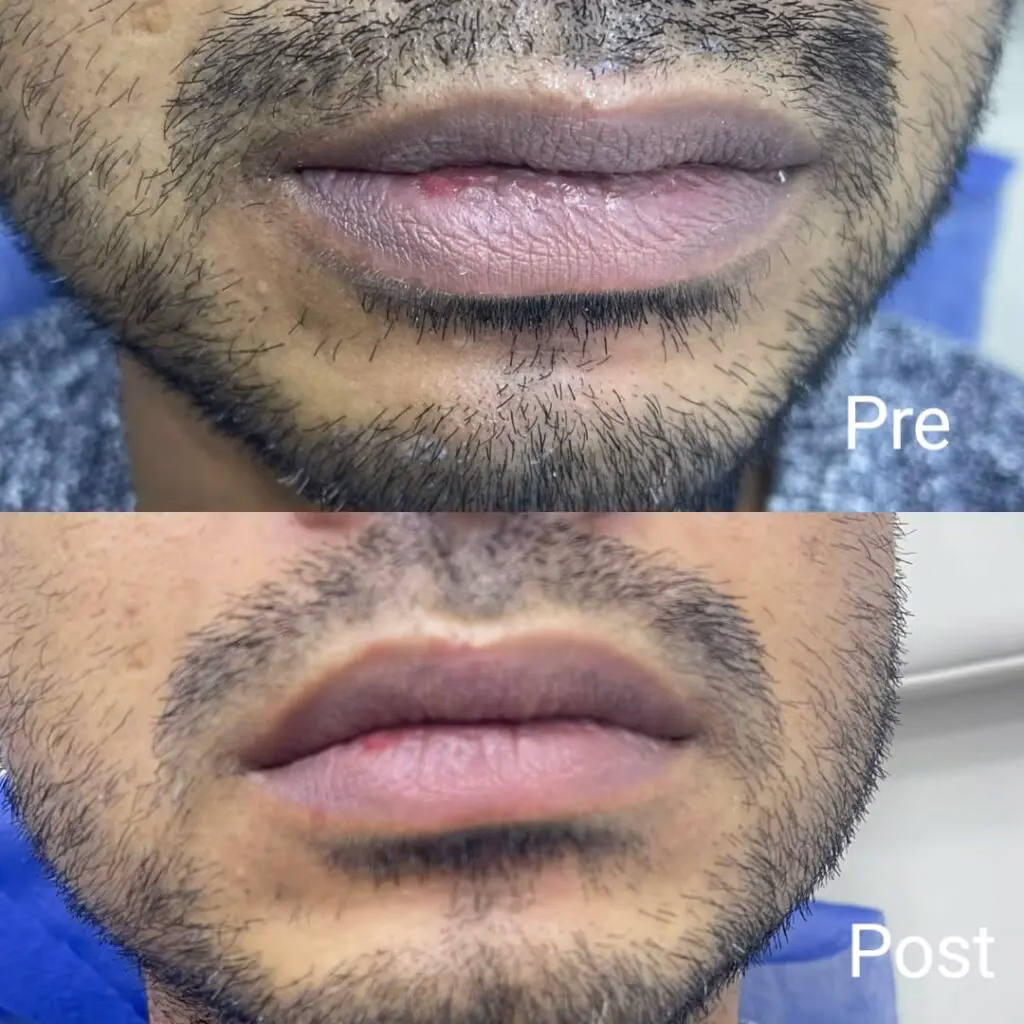 SHEGLAM PEEL TALK LIP TINT - الصورة 3